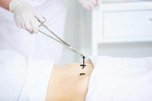 RAKTA MOSHAN: Toxin elimination and blood purification are essential in such conditions, along with internal medication.